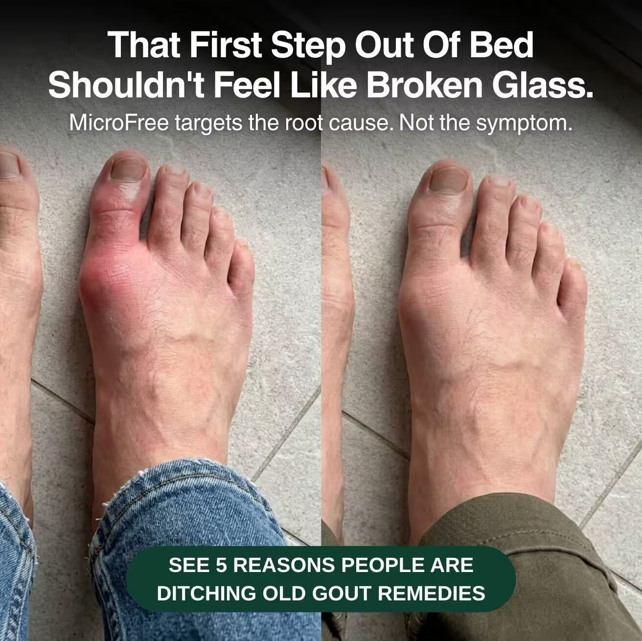 MicroFree Gout Detox 2.0